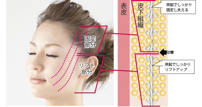 スプリングスレッドのしくみ
